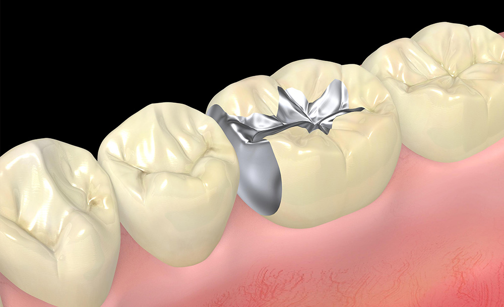 埋め込んだ後の違和感が無い精度をもっています。